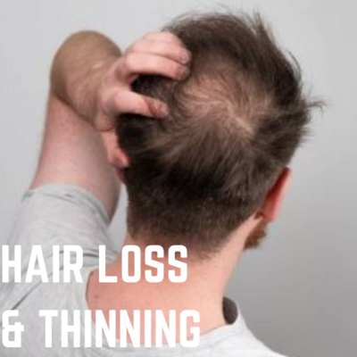 B-HAIR LOSS AND THINNING