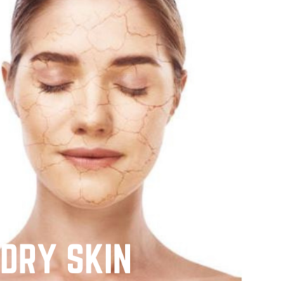 SPA-DRY SKIN